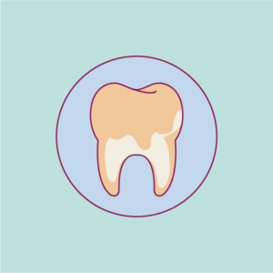 Détartrage - clinique sourire à Ajaccio