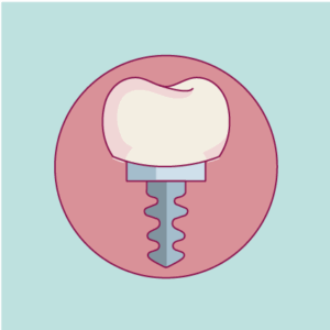 Implant dentaire - dentiste Ajaccio