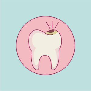 Surfaçage - dentiste à Ajaccio